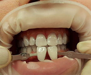 нужный тон отбеливания достигнут нужный тон отбеливания достигнут